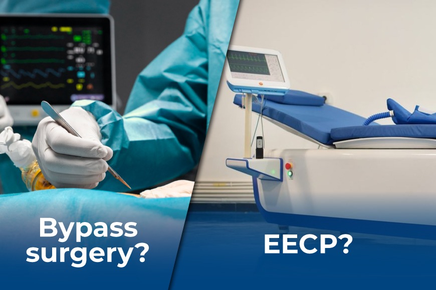 EECP Vs Bypass Surgery