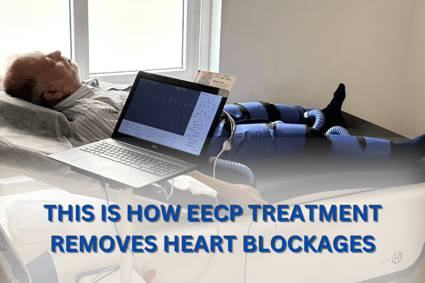 How Does the EECP Treatment Work