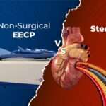 Non-Surgical-EECP-vs.-Stents