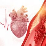 EECP Therapy for Heart Disease